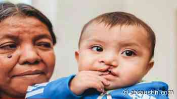 Volunteers with Austin Smiles fly to Guatemala to perform 47 child cleft lip repairs - KEYE TV CBS Austin