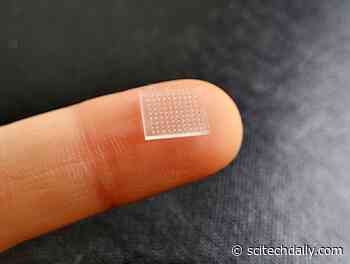 3D Printed Vaccine Patch Offers Vaccination Without a Shot – Outperforms Needle Jab in Boosting Immunity