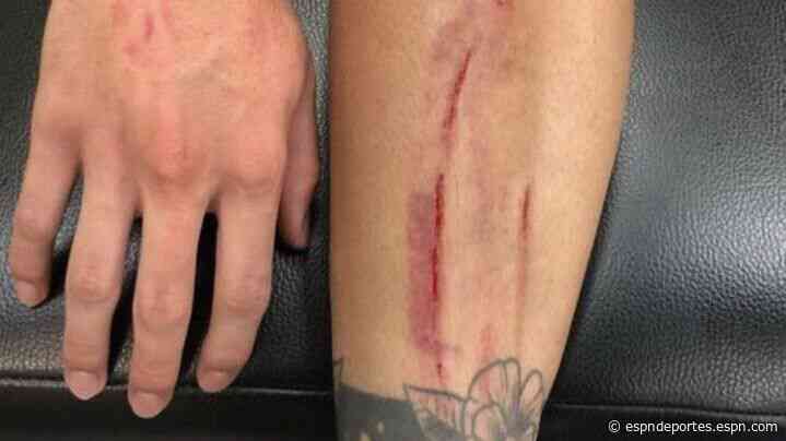 Jorge Sánchez muestra heridas luego del Clásico e ironiza sobre trabajo arbitral - ESPN Deportes