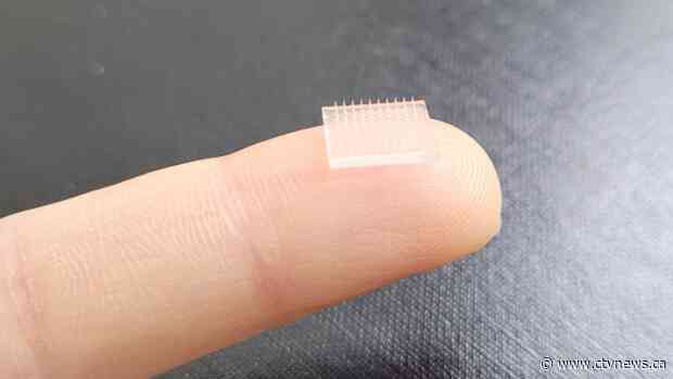 3D-printed vaccine patch can offer painless, more effective immunization: study