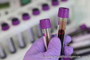 Staff shortages result in temporary closure of some Lethbridge community labs - My Lethbridge Now