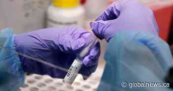 Saskatchewan sets new records for daily and active COVID-19 cases