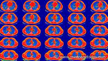 Did USPSTF's Change in Lung Cancer Screening Recs Address Inequity?