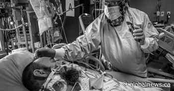 ‘We weren’t thinking about other people’: unvaccinated Alberta man on his time in ICU with COVID-19