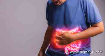 Diverticulitis en el colon: estos son los síntomas y causas - Revista Semana