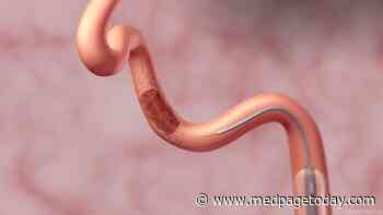 Combo Thrombectomy Approach No Better for Large Vessel Strokes