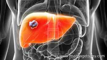 Improved DFS, but No OS Boost, With Chemo in CRC With Liver Metastases
