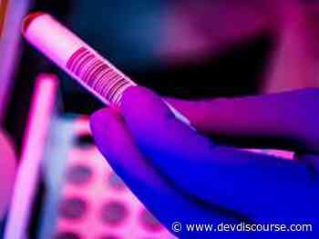 Brazil reports 15,395 new coronavirus cases, 793 deaths - Devdiscourse