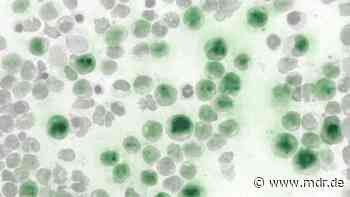 Dresden: Künstliche Intelligenz zur Leukämie-Diagnose - MDR