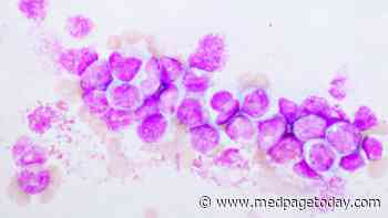Clinical Challenges: Overcoming Obstacles in Secondary AML Treatment