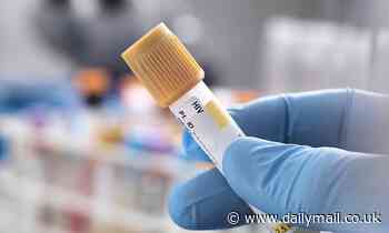 Ebola, HIV and other viruses could be treated with anti-viral developed from MONKEYS, study claims