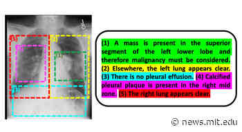 Using AI and old reports to understand new medical images - MIT News