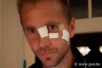 Tom Verelst (FC Bevel) herstelt van elf hechtingen: “Doelmannen beter beschermen” - Gazet van Antwerpen