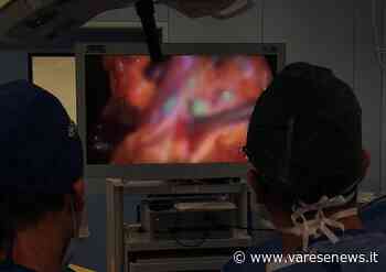 All'ospedale di Gallarate un innovativo intervento chirurgico per l'asportazione di un tumore allo stomaco - varesenews.it