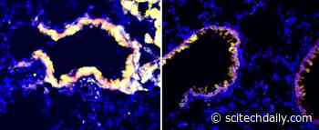 Scientists Find a New Way To Reverse Immune Suppression in Cancer Tumors