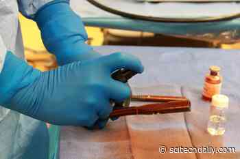 Antimicrobial Coating for Orthopedic Implants Prevents Dangerous Bacterial Infections