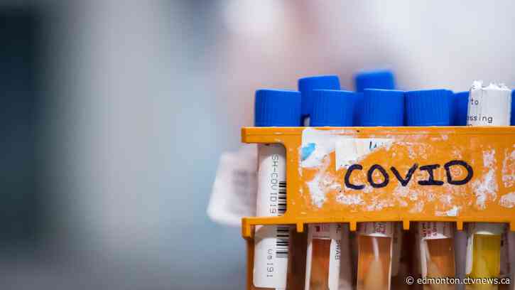 COVID-19 in Alberta: More than 4,000 new weekend cases, 21 deaths