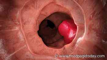 Skip Primary Resection for Asymptomatic CRC With Unresectable Metastases?