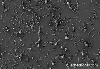 Experimental “Living Medicine” Created To Treat Drug-Resistant Infections