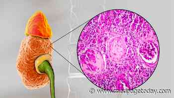 Another Face of Long COVID: Kidney Disease