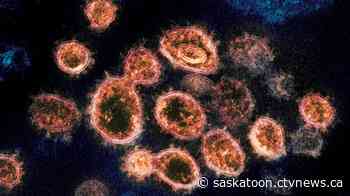 Saskatoon sees drop in COVID-19 detected in wastewater but levels remain high - CTV News Saskatoon