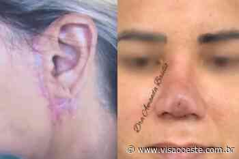 Pacientes acusam dentista de Cotia de deformar rostos após “harmonização facial” - Visão Oeste