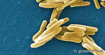 Tuberculosis outbreak in 2 northern Saskatchewan communities