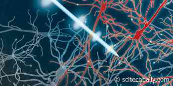 Deep Brain Stimulation Research Shows Promising Results for Treating Parkinson’s Disease