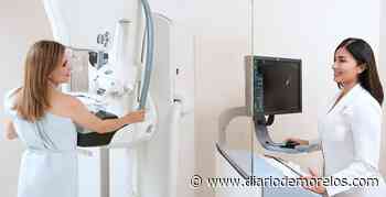 Ofrecen mastografías gratuitas en Cuernavaca, Jiutepec, Jojutla y Cuautla - Diario de Morelos