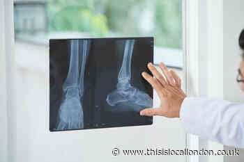 Princess Alexandra Hospital new virtual fracture clinic