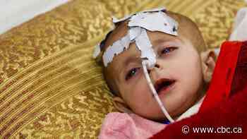 Afghanistan's anguish: Humanitarian crisis looms in wake of Taliban takeover