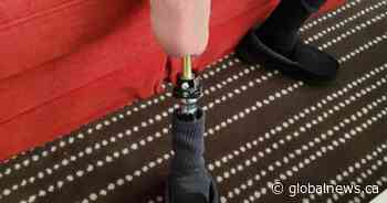 ‘Life changer’: Saskatchewan amputee raising awareness about new procedure