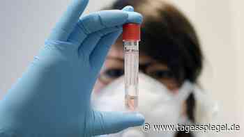 Coronavirus in der Hauptstadtregion: Inzidenz in Berlin erneut gestiegen - auf 78,9 - Tagesspiegel