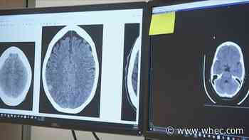 URMC conducting study on concussion effects