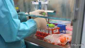 Daily Wyoming coronavirus update: 834 new cases, 1,315 new recoveries - Casper Star-Tribune Online
