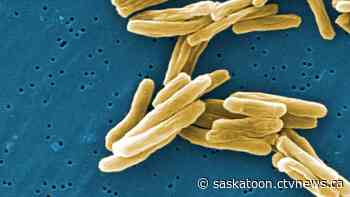 Tuberculosis outbreak declared in two northern Sask. communities, with hundreds of close contacts identified