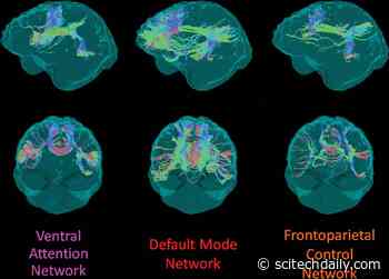 Brain’s White Matter Integrity Disrupted in People With Alzheimer’s Gene Mutation