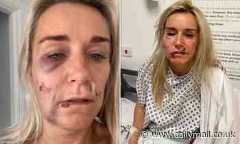 London woman, 45, scarred for life after attack by a masked gang who tried to steal £15,000 Rolex