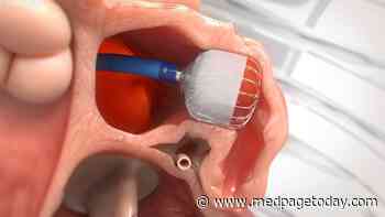 Signs Point to Half-Dose DOAC Route After Watchman Procedure