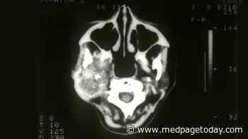 Abiraterone Active in Androgen Receptor-Positive Salivary Tumors