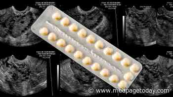 Birth Control Pills May Curb PCOS-Related Diabetes Risk