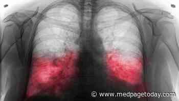 Two Factors Tied to Risk of Antibiotic Failure in Pneumonia Patients