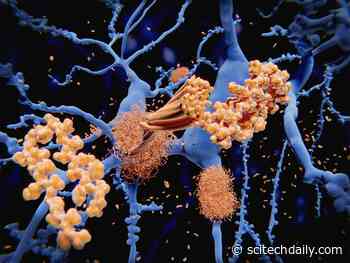 Alzheimer’s Mystery Solved: How Amyloid Beta Forms in Brain Nerve Cells