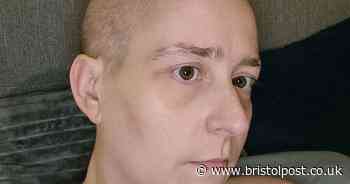 Mum with long Covid loses almost all her hair and shares inspiring message