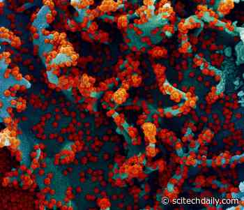 Clinical Trial Has Found Interferon Does Not Help Adults Hospitalized With COVID-19