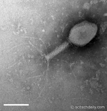 Bacteria Evolved a Multitude of Defense Systems That Offer Strong Immunity for Protection Against Viruses