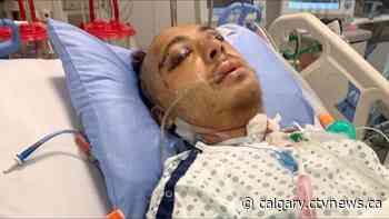 'Hopeful he'll return back to us': Victim in downtown Calgary random assault fights for life in hospital - CTV News Calgary