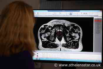 Targeted prostate cancer screening 'could benefit men with inherited syndrome' - St Helens Star