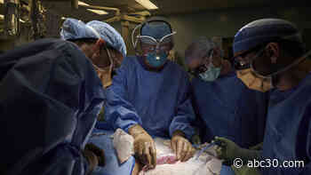 Scientists attached pig's kidney to a human body, watched organ function normally