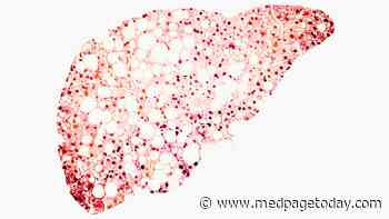 Advanced Fibrosis Tied to Most Severe Outcomes in NAFLD